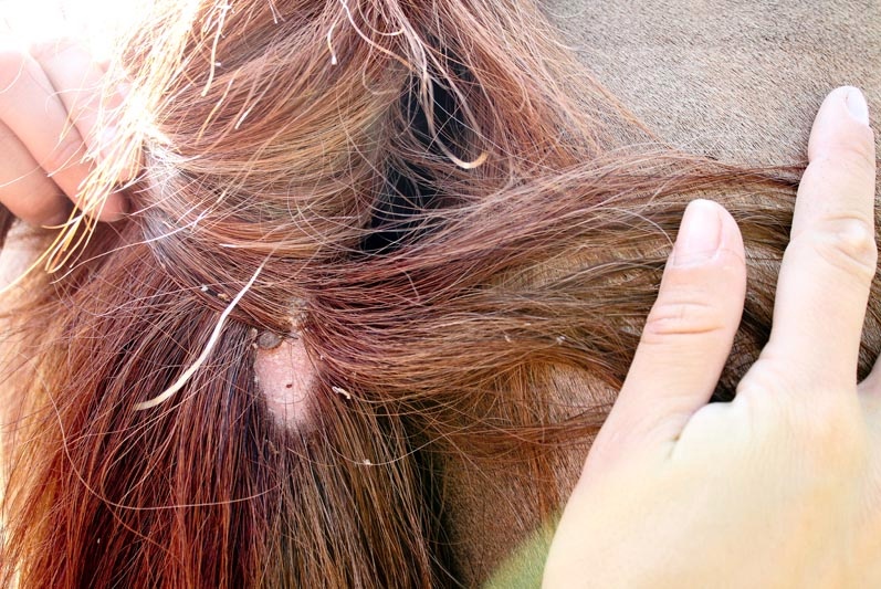 A tick attached to a scalp under reddish-brown hair